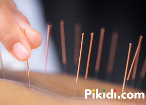 Acupuncture For Infertility in Lagos